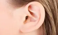 چین و چروک‌های لاله گوش نشانه چیست؟