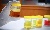 ارتباط باورنکردنی رنگ ادرار و سلامتی شما!