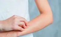 چند راهکار برای جلوگیری از خشکی پوست