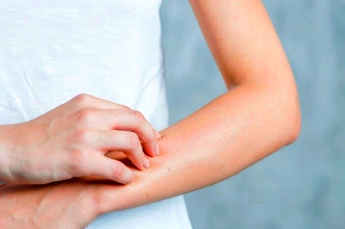 چند راهکار برای جلوگیری از خشکی پوست