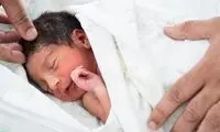 تولد نوزادی عجیب‌الخلقه در بغداد! 