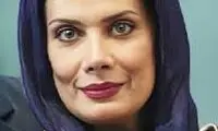 تغییر چهره قابل توجه بازیگر نام آشنای تلویزیون