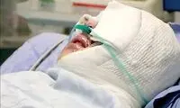 اسیدپاشی هولناک یک مرد به صورت زن رهگذر بدون هیچ دلیلی!