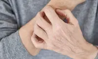 پوست شما چه بیماری‌هایی را لو می‌دهد