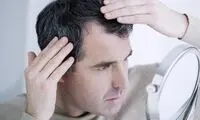 با این مکمل‌ها از سفیدی مو پیشگیری کنید