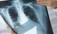 پیش‌بینی خطر مرگ با استفاده از هوش مصنوعی