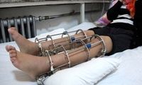 همه‌چیز درباره جراحی افزایش قد