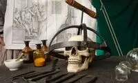 پرده‌برداری از جزئیات هولناک جراحی مغز ۳۵۰۰ساله 