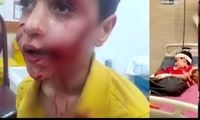 جان باختن کودک ۱۰ ساله بر اثر حمله سگ‌های ولگرد