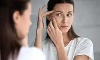 با روش‌های خانگی از بین‌بردن جای زخم آشنا شوید
