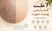 7 علت کدر شدن پوست صورت و راه‌های رفع آن