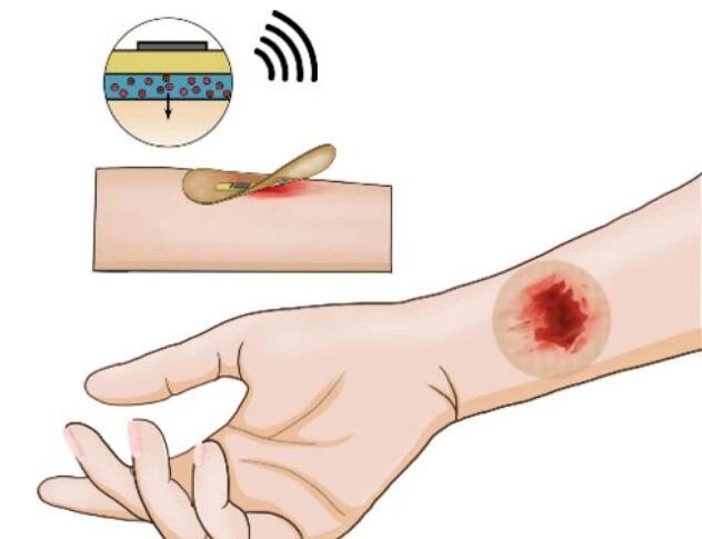 این چسب هوشمند زخم‌ها را سریع‌تر خوب می‌کند!