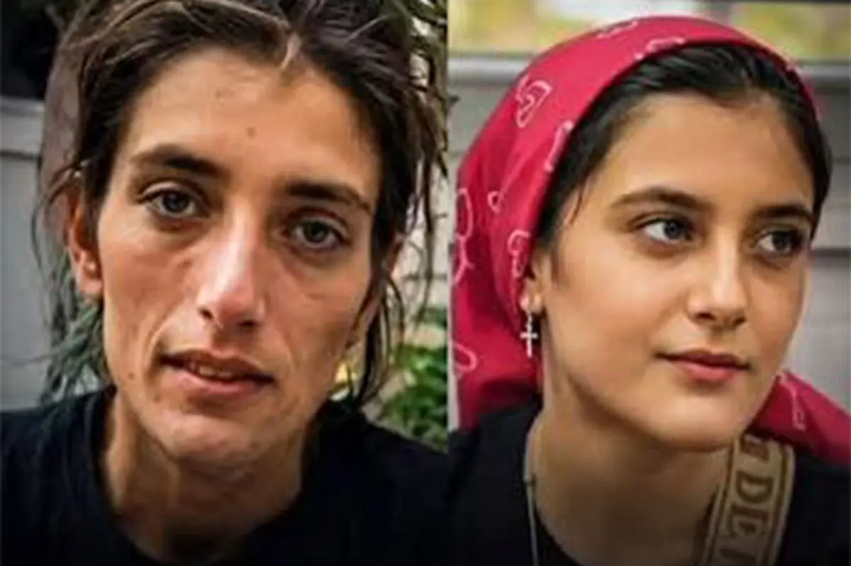 تصاویر دلگرم‌کننده از نارین، دختر سنندجی پس از درمان