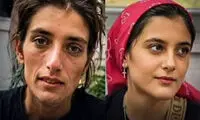 تصاویر دلگرم‌کننده از نارین، دختر سنندجی پس از درمان
