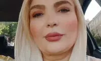 چهره جدید خانم بازیگر، پس از چند عمل زیبایی!
