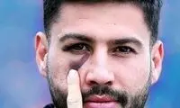 ستاره استقلال دوباره از ناحیه چشم مصدوم شد