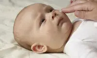 با آکنه‌ی صورت نوزادان چه کنیم؟