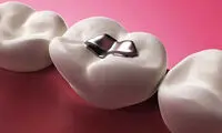 داروی آلزایمر جایگزین پر کردن مصنوعی دندان ها