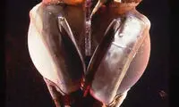 اولین قلب مصنوعی جهان +عکس