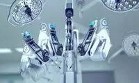 جراحی مغز با ربات تنها در دو دقیقه و نیم!