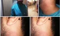 پزشک متخصص اعصاب، پرستار شیرازی را کتک زد!
