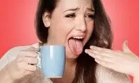 چگونه سوختگی زبان را به سرعت درمان کنیم؟