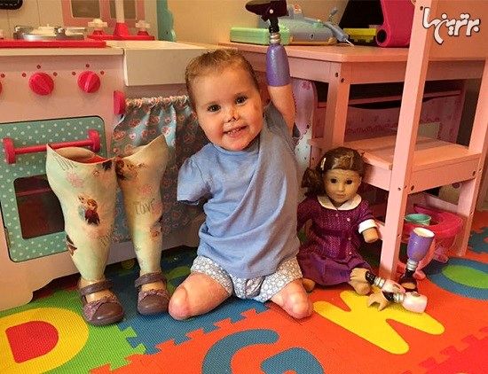عروسک دختر دوساله ای که دست و پا ندارد
