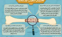اینفوگرافیک؛ علائم پوکی استخوان را بهتر بشناسید