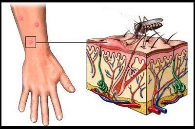 درباره بیماری‌های مشترک انسان و حیوان بدانید