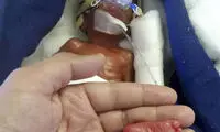 نجات کم وزن ترین نوزاد جهان
