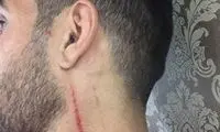 استوری احمدزاده و آبشکی که جای زخم نداشت!
