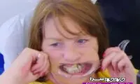 10 سال چسبکاری به خاطر ترس از پزشک!