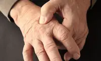 آب و هوا بر شدت درد ناشی از آرتروز موثر است