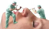 بازار داغِ جراحی‌های زیبایی در آستانه نوروز