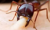 عکس: لحظه گاز گرفتن مورچه از انسان
