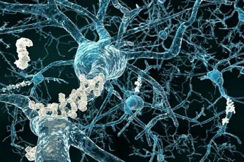 مقابله با آلزایمر به کمک نانوپاک‌کننده‌ها