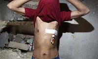 روایتی دردناک از فروش کلیه +عکس (16+)