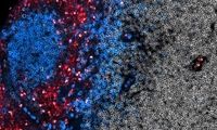 بهبود ایمنی درمانی سرطان با یک واکسن