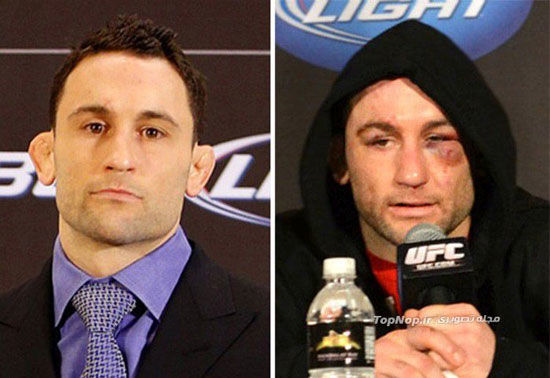 ورزشکاران UFC قبل و بعد از مسابقه! +عکس