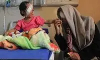 زن و دختر قربانی اسيد پاشی تهديد به مرگ شدند (18+)