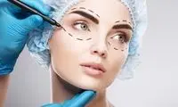 آیا عمل زیبایی بینی با پوشش بیمه sos امکان پذیر است؟