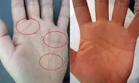 تغییر سرنوشت به ضرب و زور عمل زیبایی!