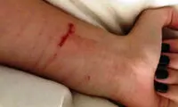 خون بازی؛ خودنمایی نوظهور دخترانه
