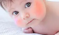 بچه لپ قرمزی‌تان احتمالا بیمار است!