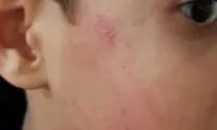 با عاملان تنبیه دانش آموز قزوینی برخورد می‌شود