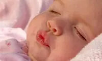 بهترین راه‌ کارها برای درمان لب‌ های خشکی زده کودک