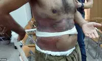 استفاده داعش از گاز خردل در عراق +عکس