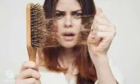 طاسی مردانه؛ همیشه هم ژنتیک مقصر نیست