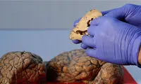 مرکزی که 3 هزار مغز انسان در آن نگهداری می‌شود!