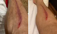 عالیشاه را در گوای هند زخمی کردند!